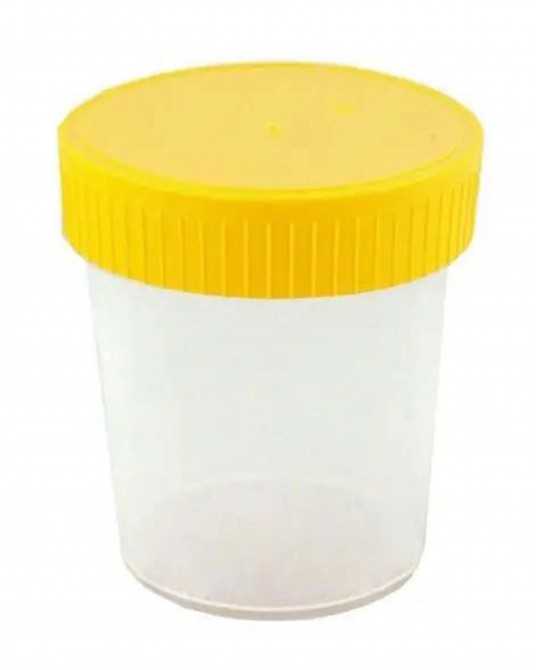 Urine container 100 ml, 100 pcs