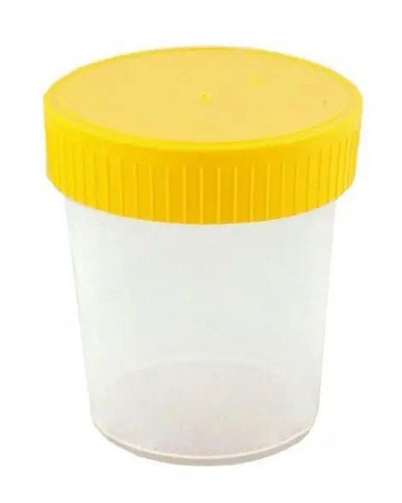 Urine container 100 ml, 100 pcs