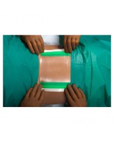 Nobafilm adhesive surgical film, 30 x 16 cm, 20 pcs